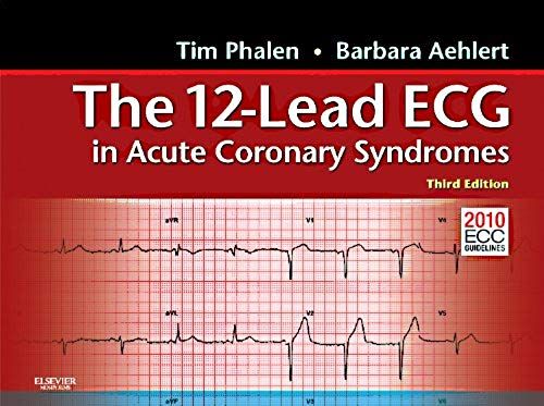 The 12-Lead Ecg In Acute Coronary Syndromes: Pocket Reference For The 12-Lead Ecg In Acute Coronary Syndromes