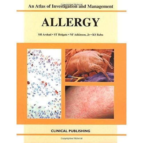 Allergy