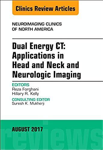 Dual Energy Ct: Applications In Head And Neck And Neurologic Imaging, An Issue Of Neuroimaging Clinics Of North America
