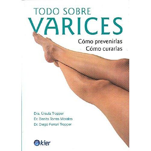 Todo Sobre Varices