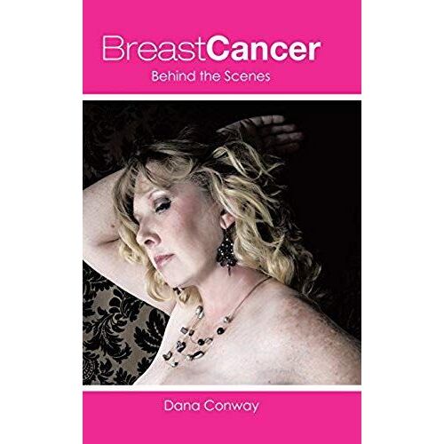 Breast Cancer
