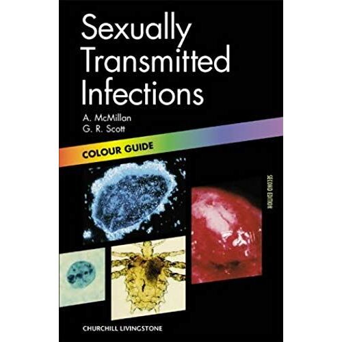 Sexually Transmitted Diseases: Colour Guide (Colour Guides)