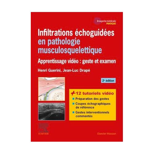 Infiltrations Échoguidées En Pathologie Musculosquelettique