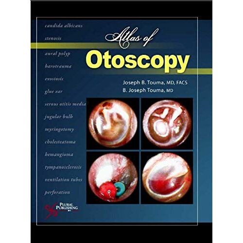 Atlas Of Otoscopy