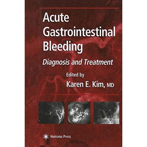 Acute Gastrointestinal Bleeding