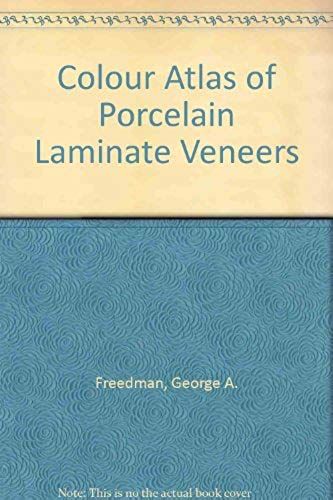 Color Atlas Of Porcelain Laminate Veneers