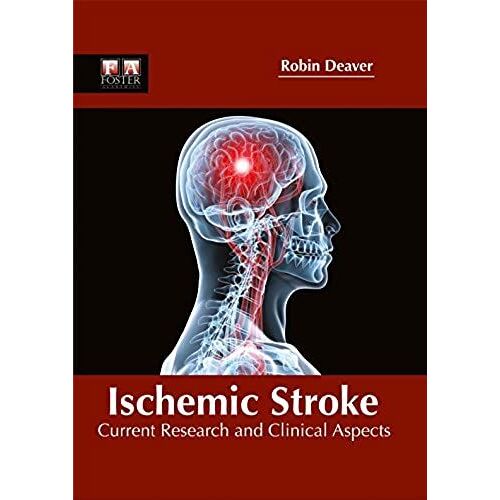 Ischemic Stroke