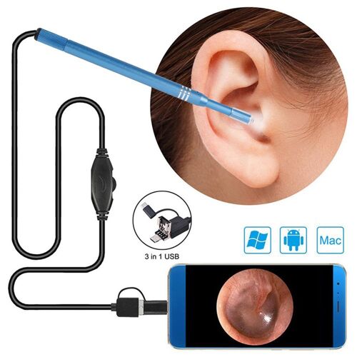 Kit D'otoscope Endoscopique Auriculaire Numérique Hd 5,5 Mm Avec Wi-Fi, Led Et Compatibilité Usb Pour Les Inspections Sanitaires