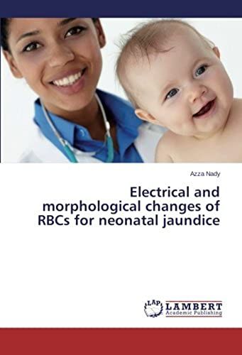 Electrical And Morphological Changes Of Rbcs For Neonatal Jaundice