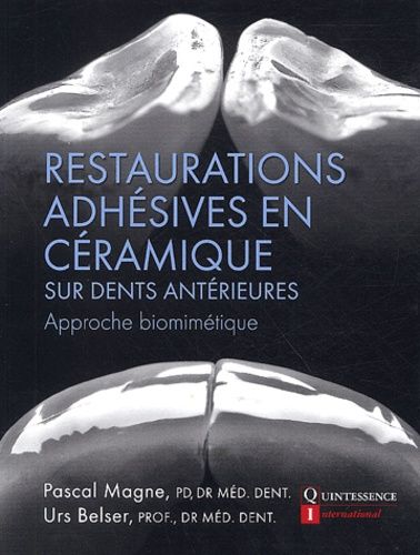 Restauration Adhésives En Céramique Sur Dents Antérieures - Approche Biométrique