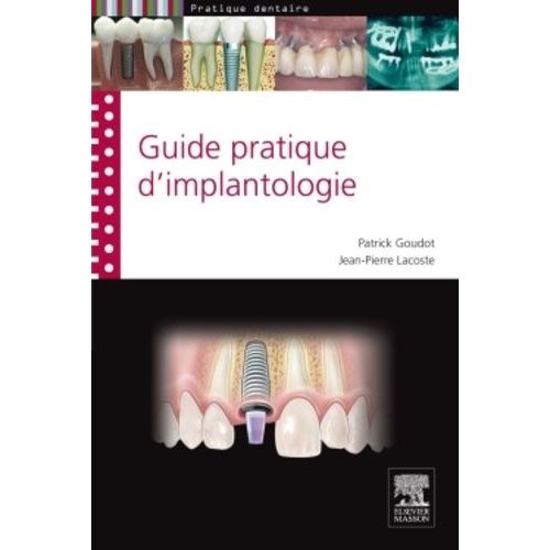 Guide Pratique D'implantologie
