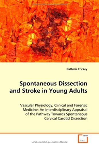 Spontaneous Dissection And Stroke In Young Adults