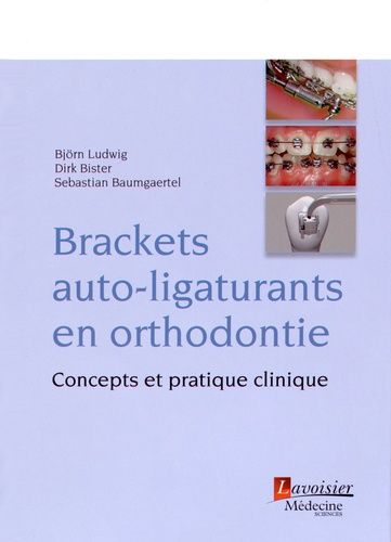 Brackets Auto-Ligaturants En Orthodontie - Concepts Et Pratique Clinique