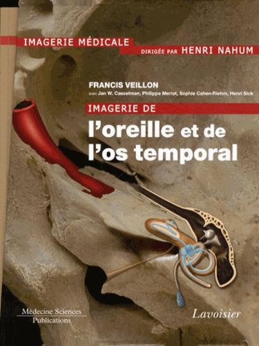 Imagerie De L'oreille Et De L'os Temporal - 6 Volumes + Fascicule