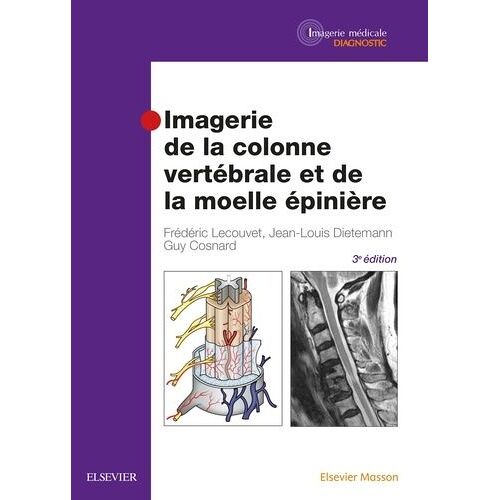 Imagerie De La Colonne Vertébrale Et De La Moelle Épinière