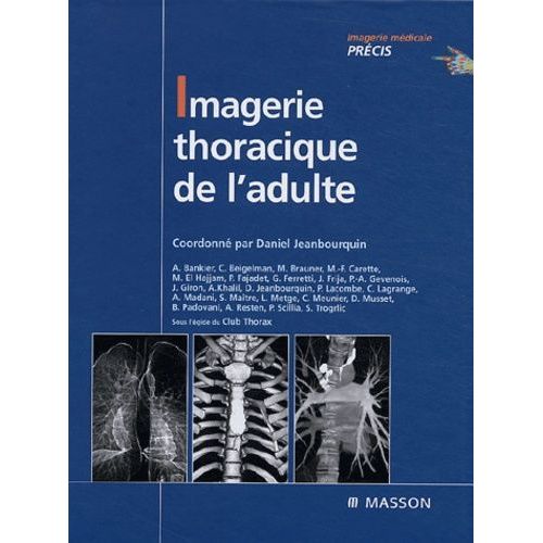 Imagerie Thoracique De L'adulte