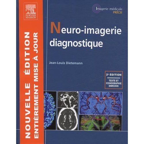 Neuro-Imagerie Diagnostique