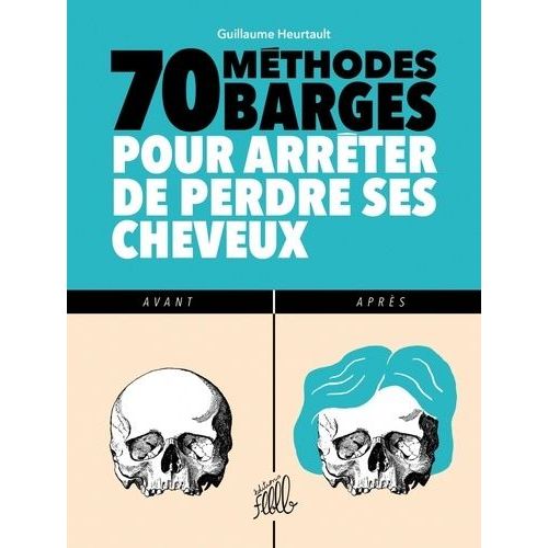 70 Méthodes Barges Pour Arrêter De Perdre Ses Cheveux