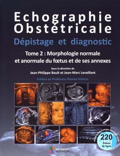 Echographie Obstétricale, Dépistage Et Diagnostic - Tome 2, Morphologie Normale Et Anormale Du Foetus Et De Ses Annexes