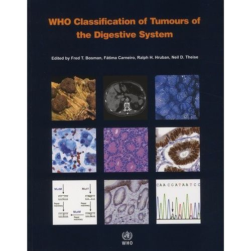 Who Classification Of Tumours Of The Digestive System