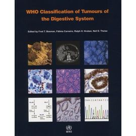 Who Classification Of Tumours Of The Digestive System