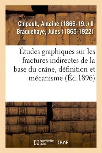 Études Graphiques Sur Les Fractures Indirectes De La Base Du Crâne, Définition Et Mécanisme