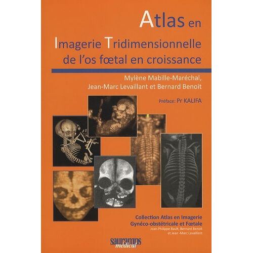Atlas En Imagerie Tridimensionneelle De L'os Foetal En Croissance