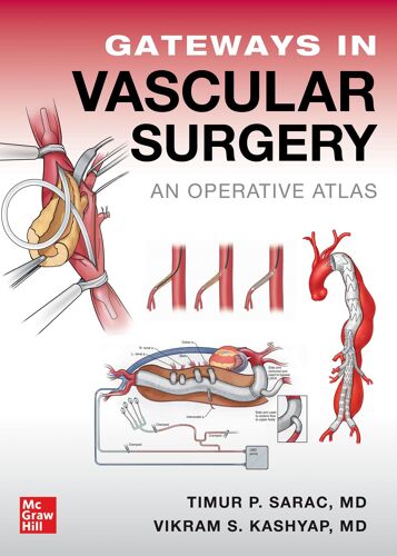 Gateways In Vascular Surgery: An Operative Atlas