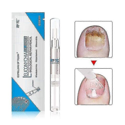 3ml Traitement Des Champignons Huile À Ongles Stylo Anti-Champignon Cuticule Dent