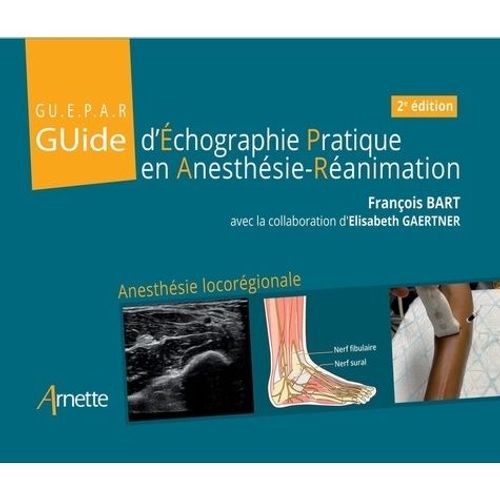 Guide D'échographie Pratique En Anesthésie-Réanimation