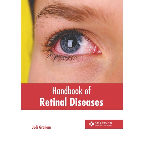 Handbook Of Retinal Diseases