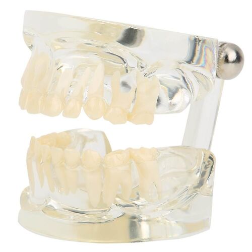 Modèle primaire clair Modèle de dents de lait pour la maternelle, l'hôpital, le laboratoire