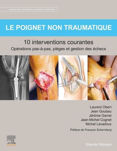 Le Poignet Non Traumatique : 10 Interventions Courantes - Manuel De Chirurgie Du Membre Supérieur