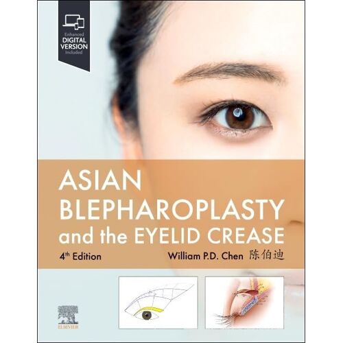Asian Blepharoplasty And The Eyelid Crease