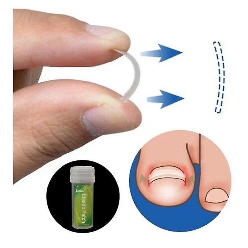 Kit De Correction Des Ongles Incarnés 6 Pièces - Outils De Soin Des Ongles Pour Usage Domestique Et Professionnel - Acier Inoxydable Et Application Facile