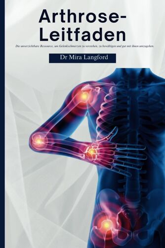 Arthrose-Leitfaden: Die Unverzichtbare Ressource, Um Gelenkschmerzen Zu Verstehen, Zu Bewältigen Und Gut Mit Ihnen Umzugehen (Chronic Care Guides Series)