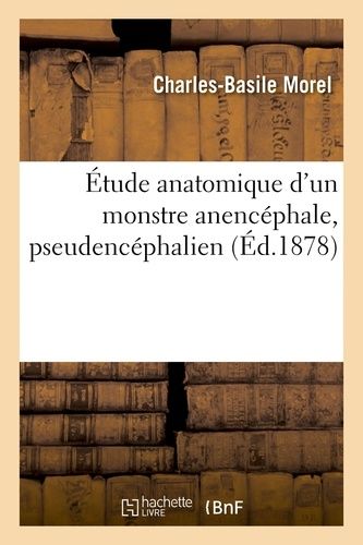 Étude Anatomique D'un Monstre Anencéphale Pseudencéphalien De G. Saint-Hilaire