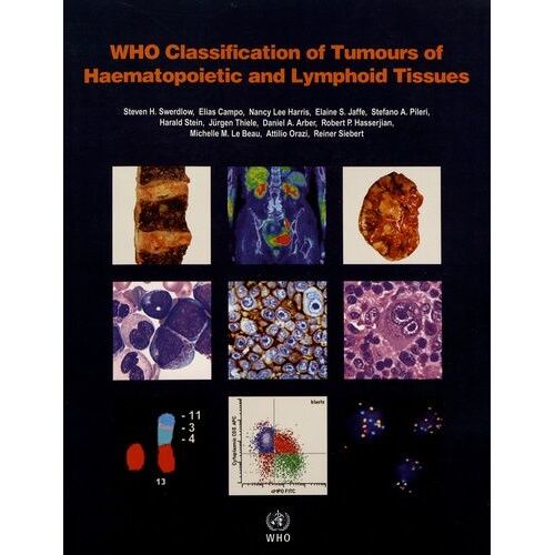 Who Classification Of Tumours Of Haematopoietic And Lymphoid Tissues [Op]