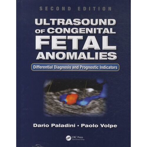 Ultrasound Of Congenital Fetal Anomalies - Differential Diagnosis And Prognostic Indicators