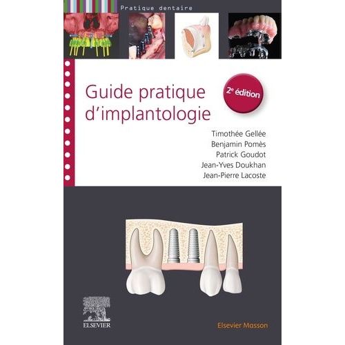 Guide Pratique D'implantologie