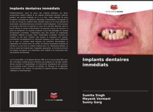 Implants Dentaires Immédiats