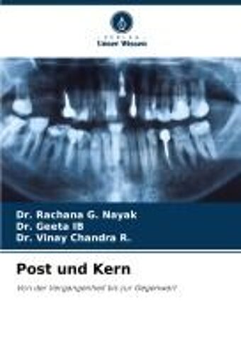 Post Und Kern