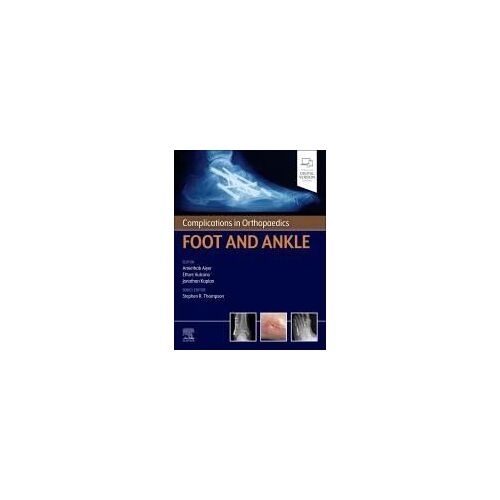 Complications In Orthopaedics: Foot And Ankle