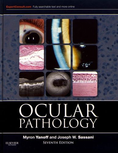 Ocular Pathology