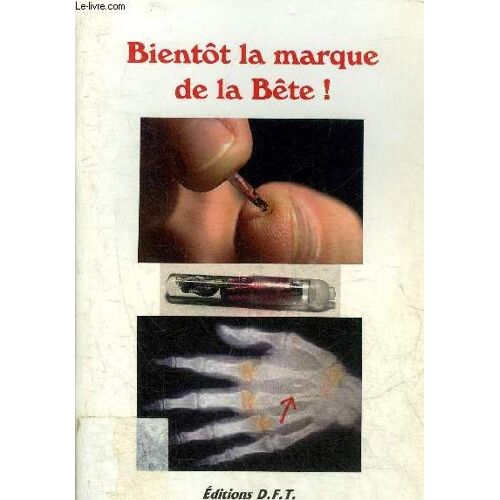 Bientot La Marque De La Bete.
