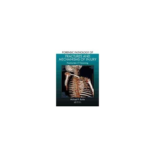 Forensic Pathology Of Fractures And Mechanisms Of Injury