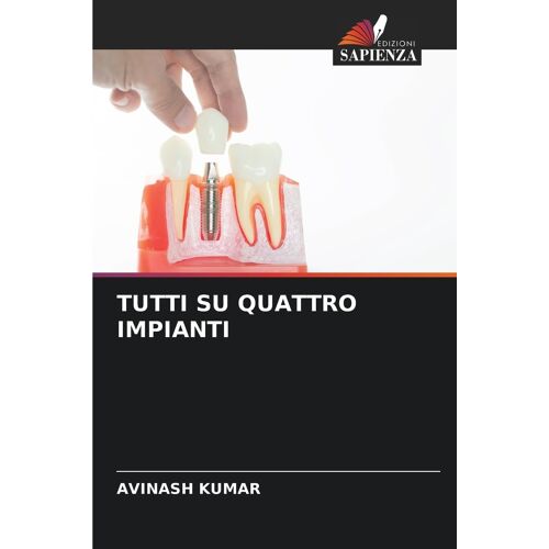 Tutti Su Quattro Impianti