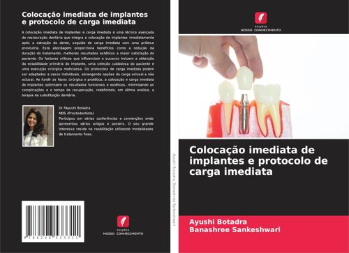 Colocação Imediata De Implantes E Protocolo De Carga Imediata