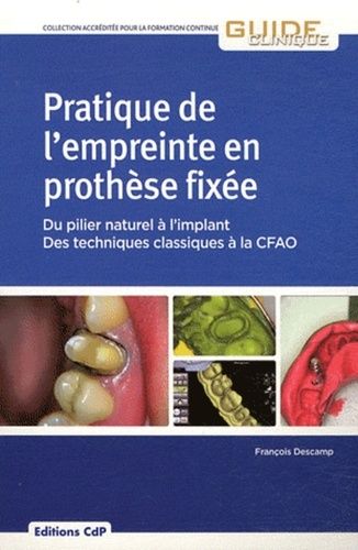 Pratique De L'empreinte En Prothèse Fixée - Du Pilier Naturel À L'implant, Des Techniques Classiques À La Cfao