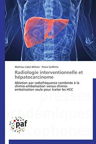 Radiologie Interventionnelle Et Hépatocarcinome